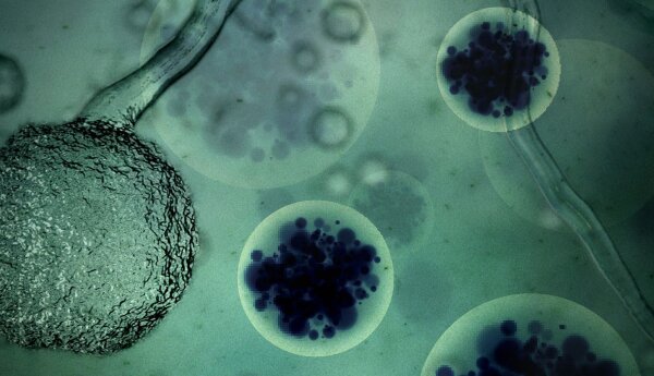 Jak medycyna poradziła sobie z największymi epidemiami? „Wirus – niewidzialny zabójca” w Discovery